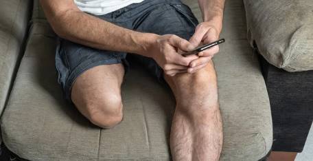 Amputation & Loss of Limb