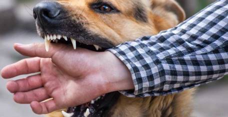 Dog Bites & Animal Attacks